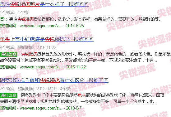 汕头龟头尖锐锐湿疣图片