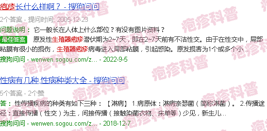 汕头生殖器疱疹图