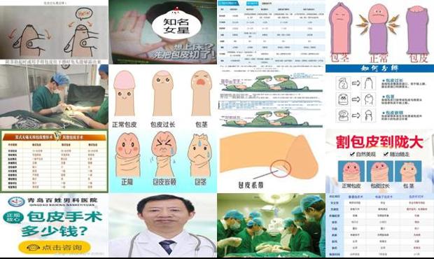 汕头哪家医院割包皮