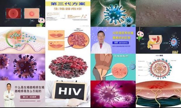 汕头生殖器疱疹图