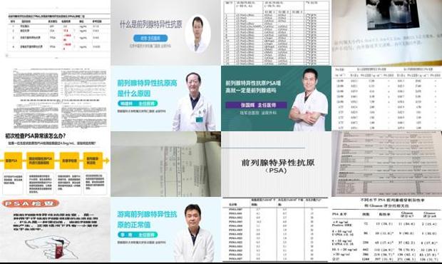 汕头前列腺特异抗原正常值