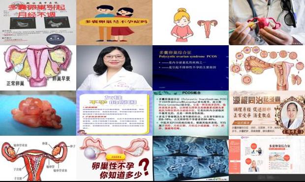 汕头治疗卵巢性不孕