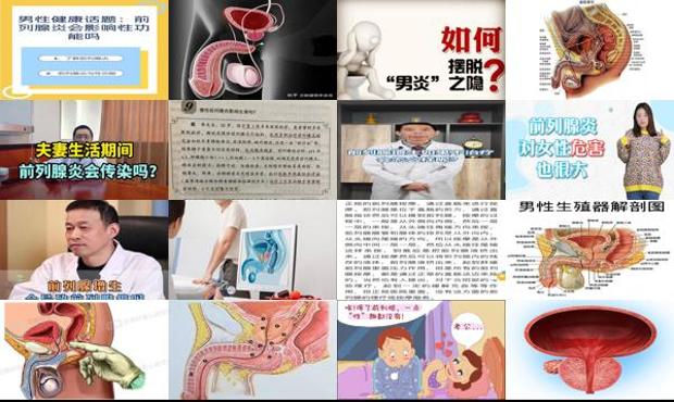 汕头前列腺会不孕吗