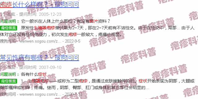汕头生殖疱疹症状图片大*