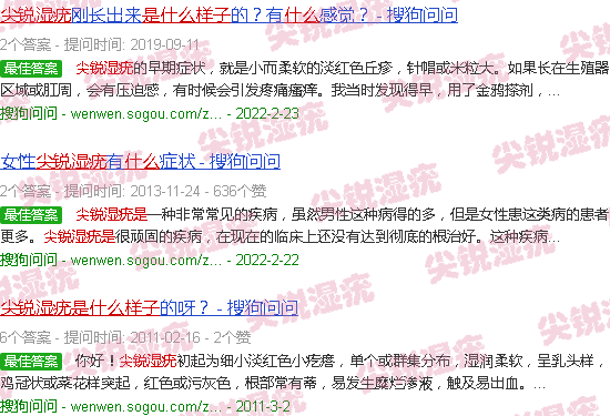 汕头尖锐湿疣是什么样