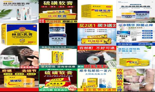 汕头阴虱用什么药膏比较好