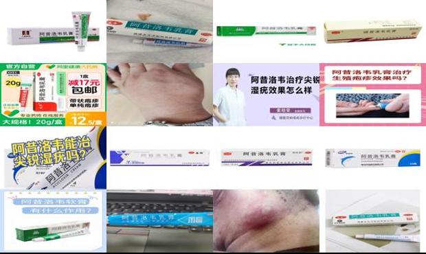 汕头阿昔洛韦软膏治疗尖锐湿疣