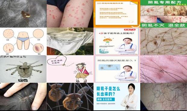 汕头长阴虱的原因