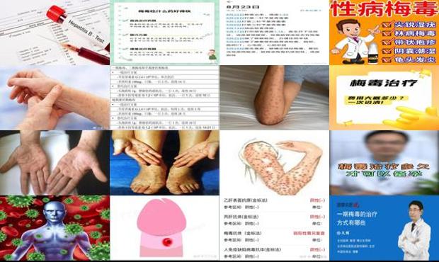 汕头梅毒怎么治疗