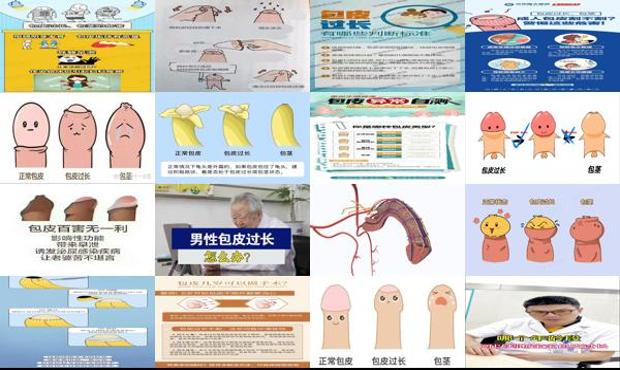 汕头男生包皮过长怎么办