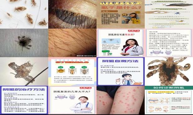 汕头阴虱虫子要怎么才能*消除呢
