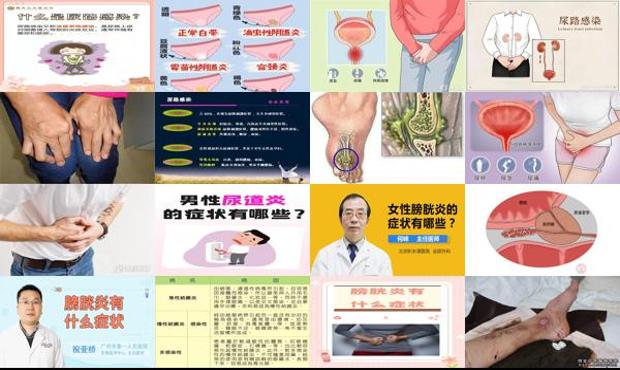 汕头尿路炎症状有哪些状况