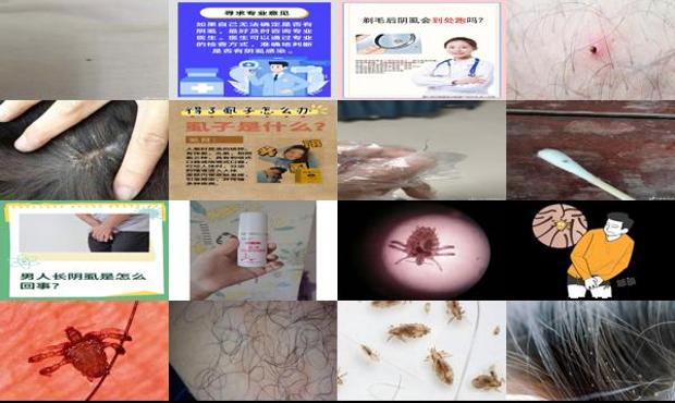 汕头怎么判断自己有没有阴虱