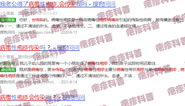 汕头疱疹*会传染别人吗