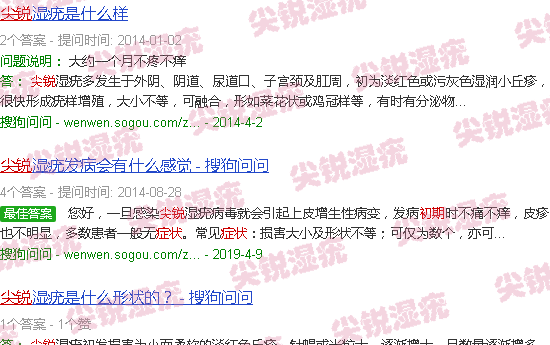 汕头尖锐湿疹初期症状图片
